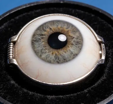 平顶山医院眼科专家与正目义眼技师研讨义眼定制方案